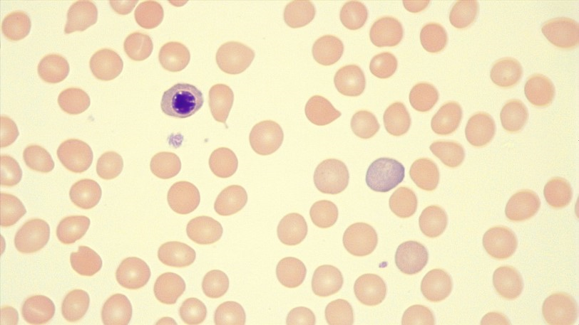 Polychromatophilic Erythrocyte