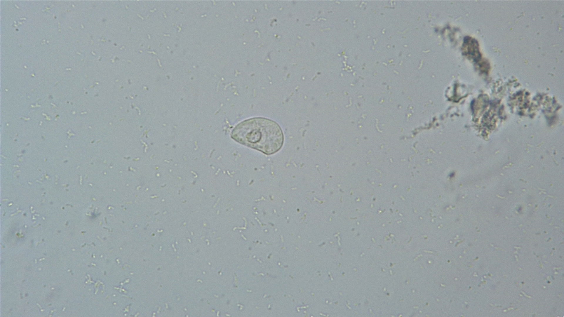 Transitional cell
