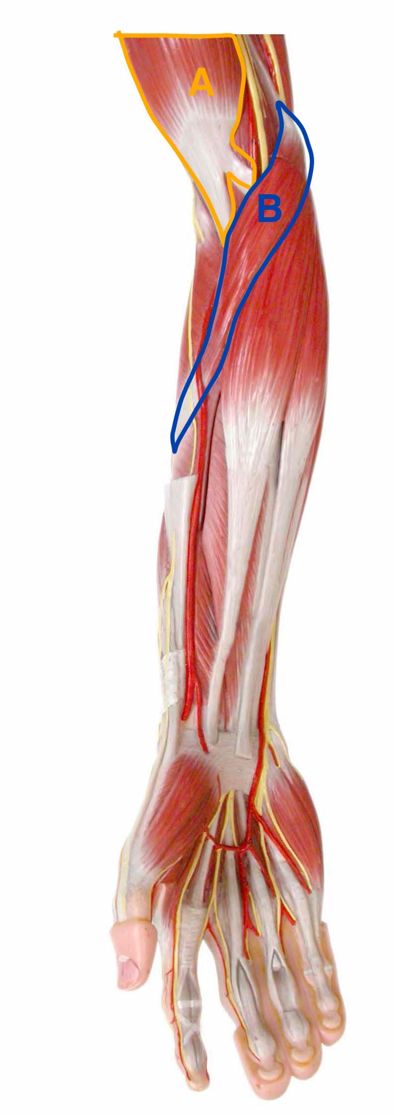 Image of arm model, anterior forearm view, with two muscles labeled for identification.